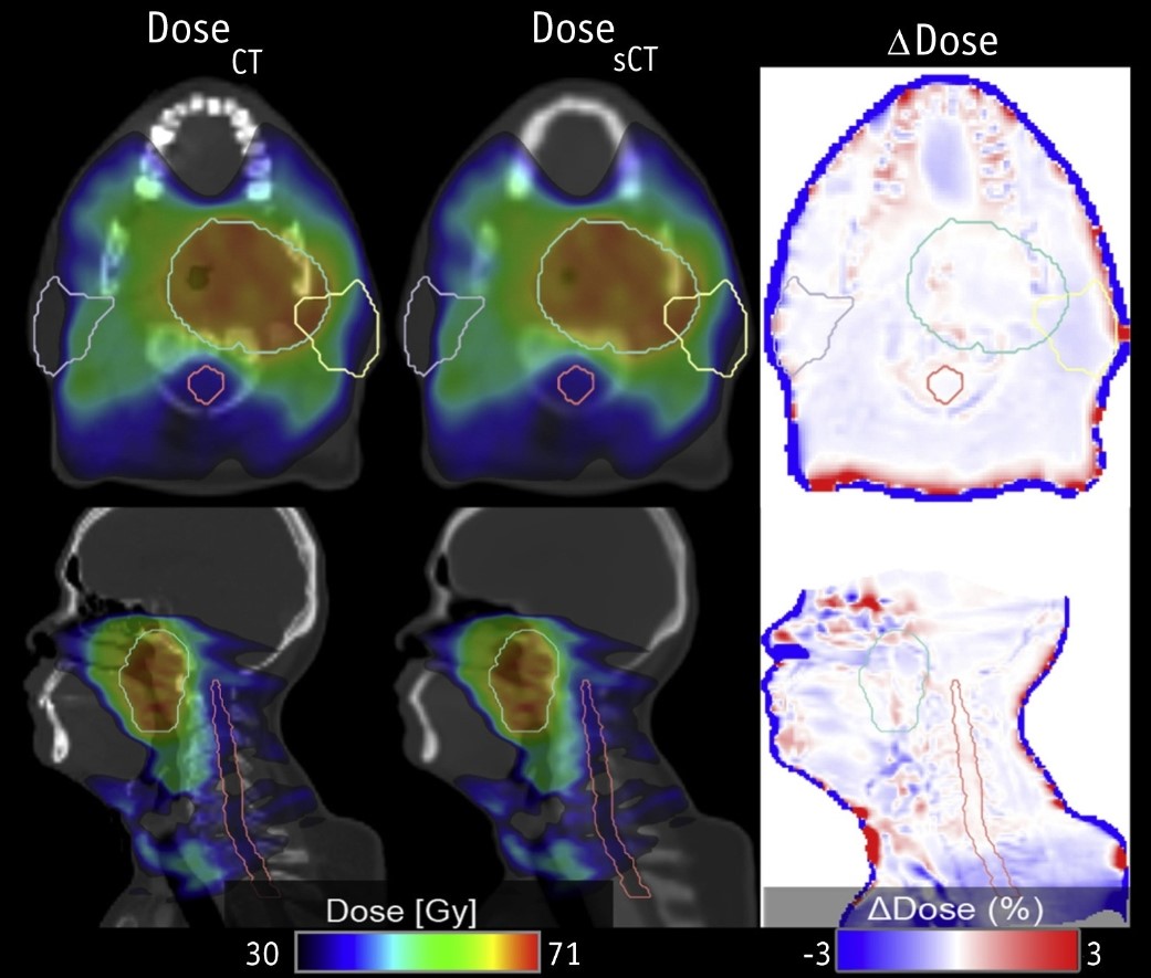 Figure 1: Example of PET Imaging