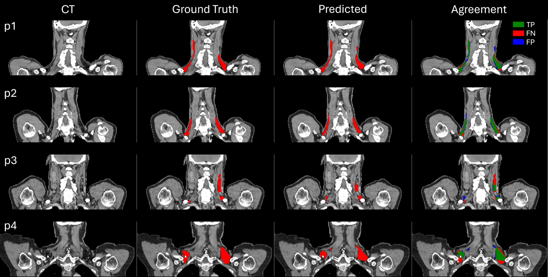 Figure 1: BAT Segmentation