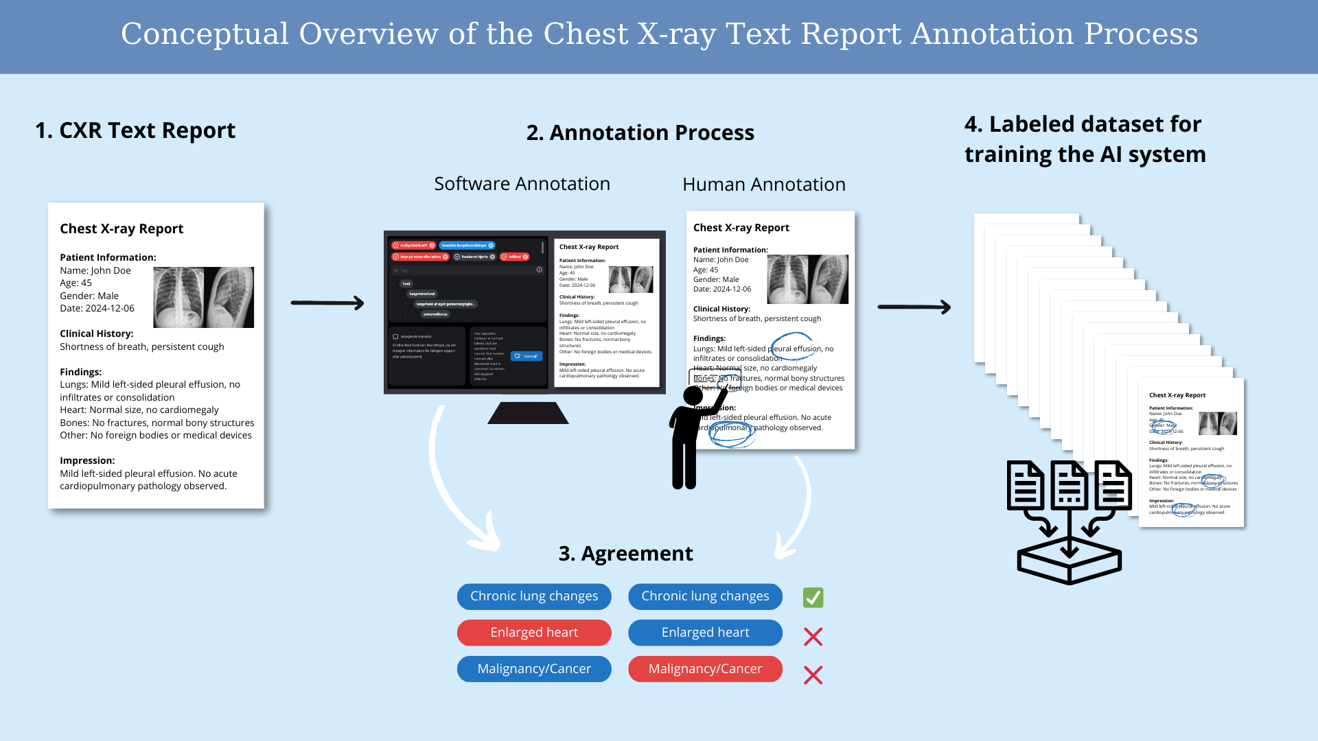 Figure 1: Overview of the Chest X-ray